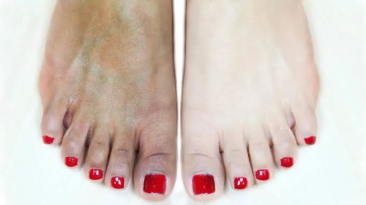 27054 turmeric yogurt foot mask