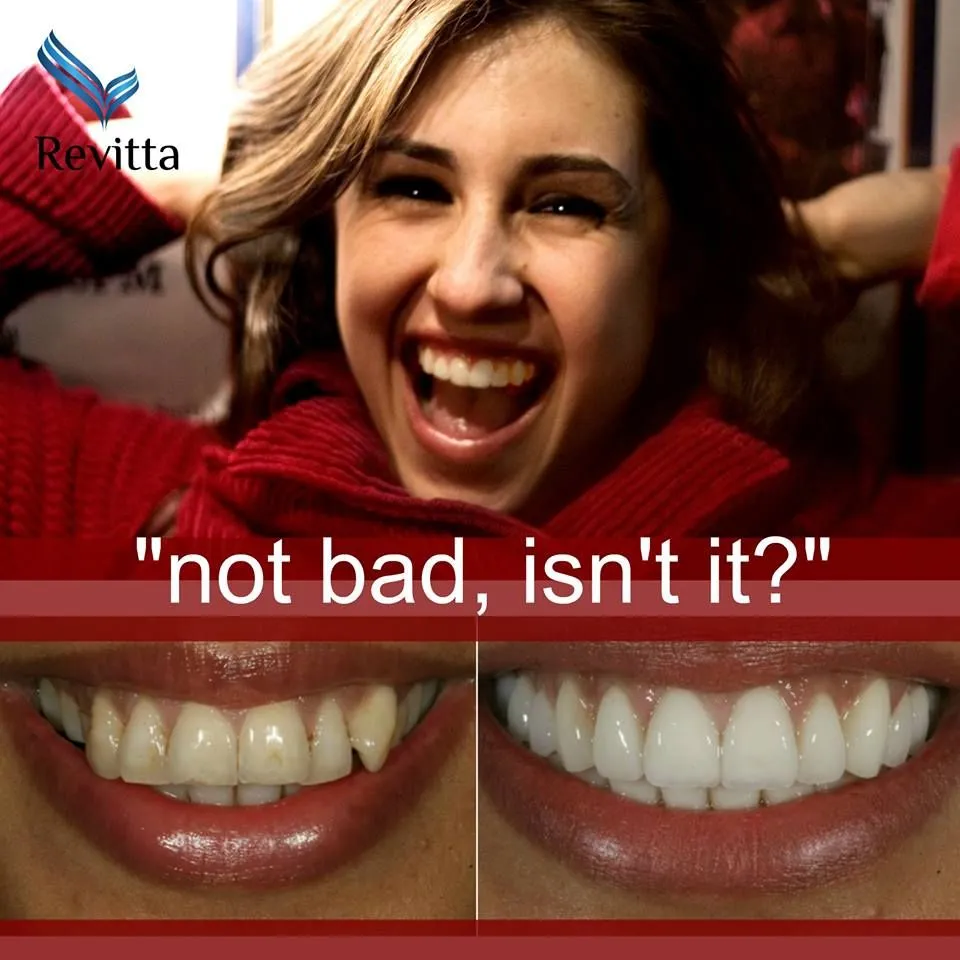 27055 teeth whitening cost