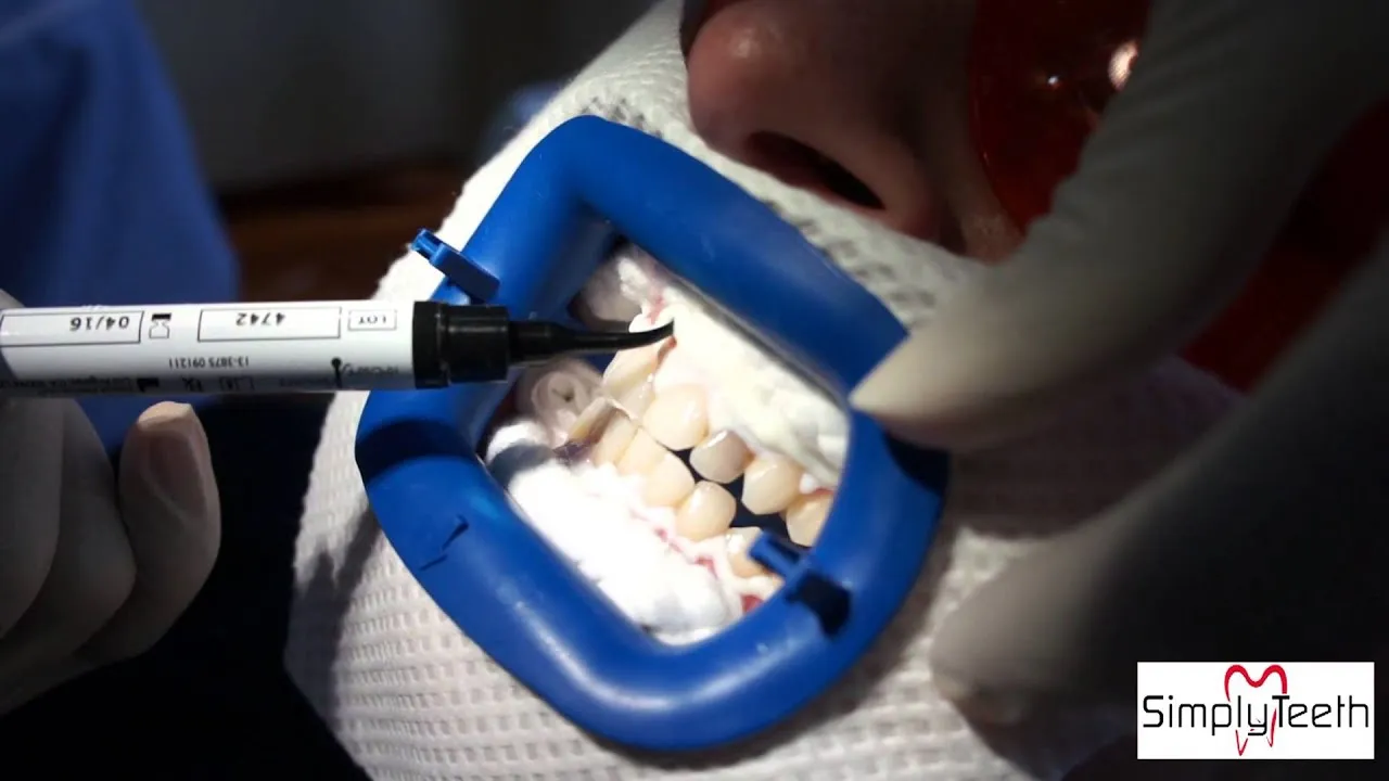 27059 dentist consultation