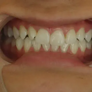 /img/27059-teeth-whitening-conclusion.webp