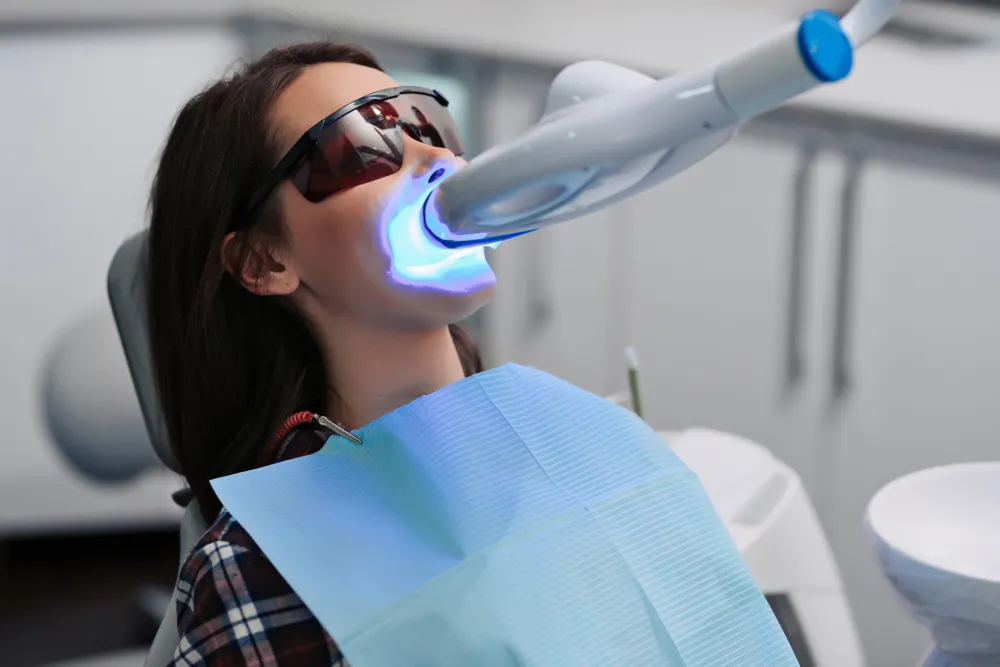 27060 professional teeth whitening