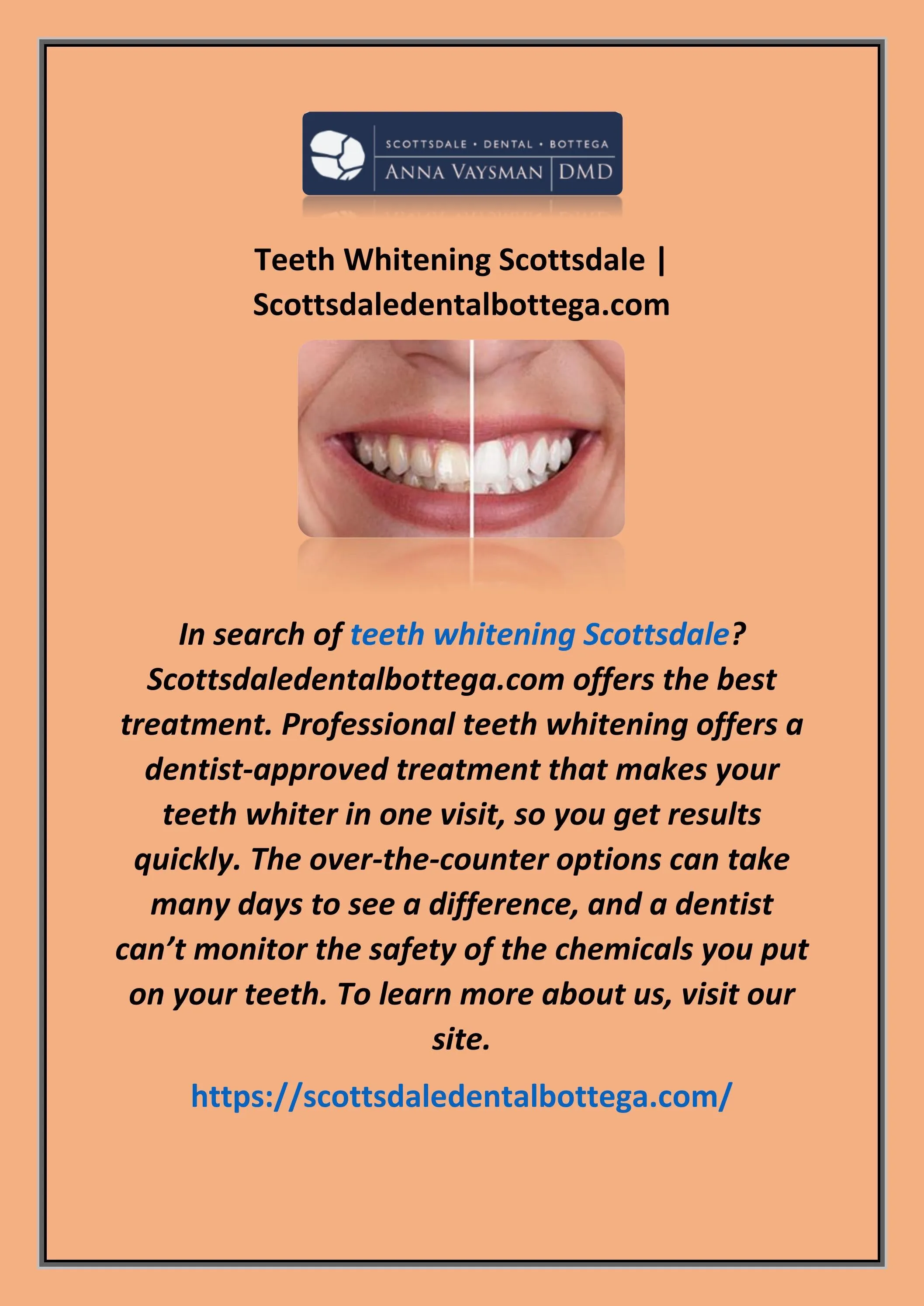 27060 teeth whitening take home kits