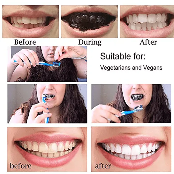/img/27066-charcoal-teeth-whitening-organic-7.webp