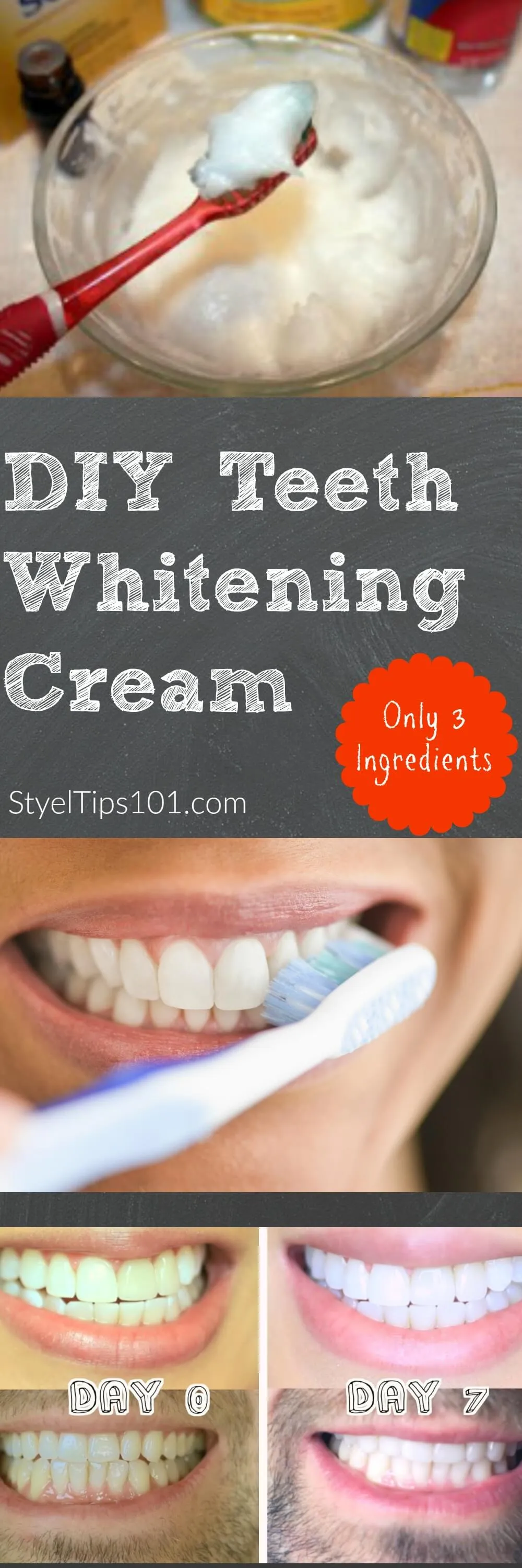 27070 teeth whitening tin foil materials