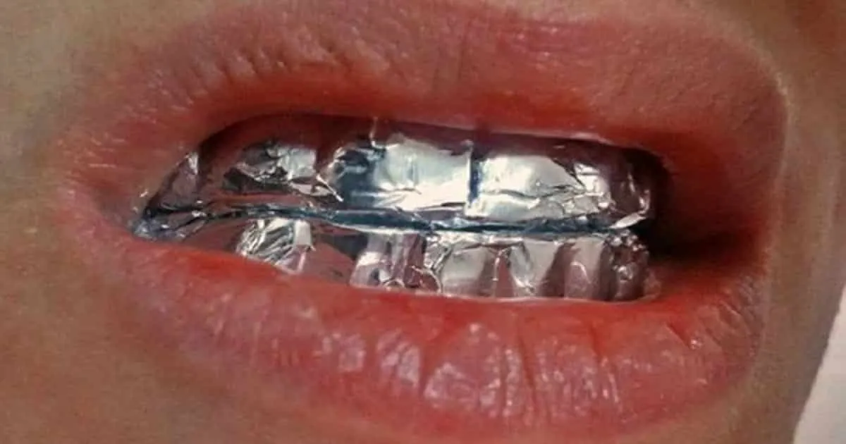 /img/27070-teeth-whitening-tin-foil-smile.webp