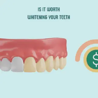 /img/27072-teeth-whitening-smile.webp