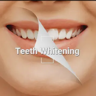 /img/27077-avoiding-stains.webp