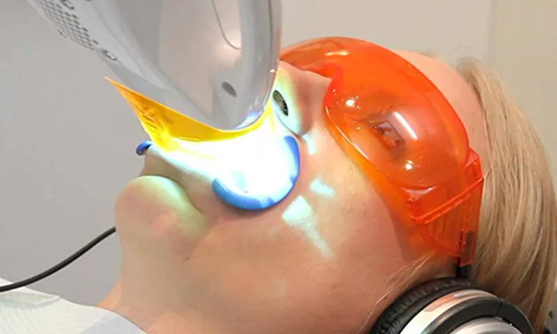 27077 teeth whitening procedure