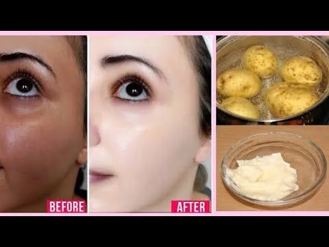 27081 potato hydration skin