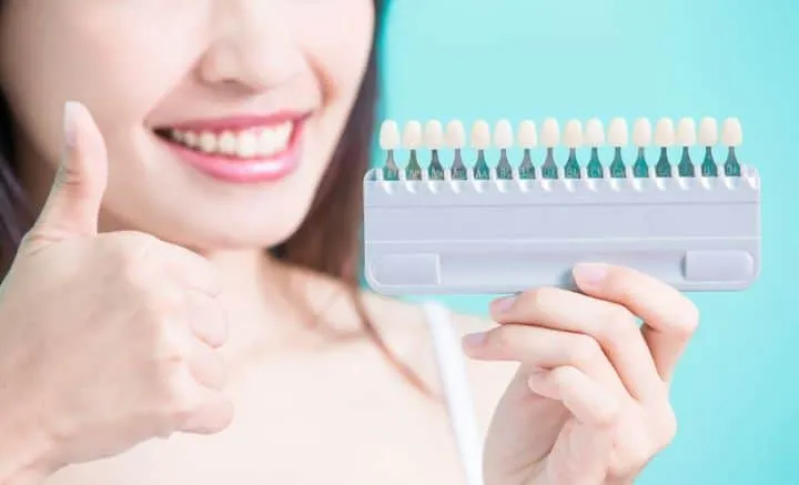 27082 teeth whitening cost main