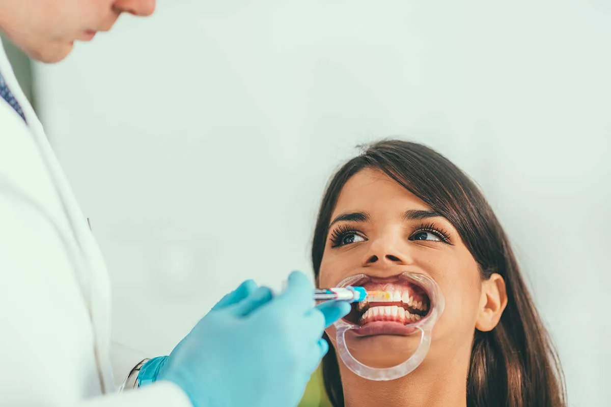 27085 teeth whitening procedures at home