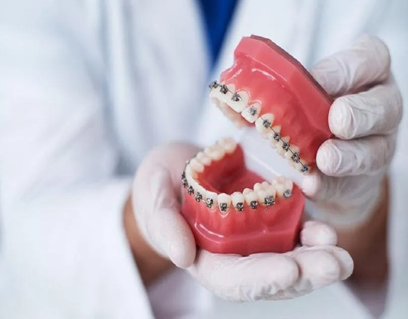 27087 professional teeth whitening