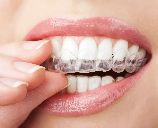 27087 teeth whitening maintenance