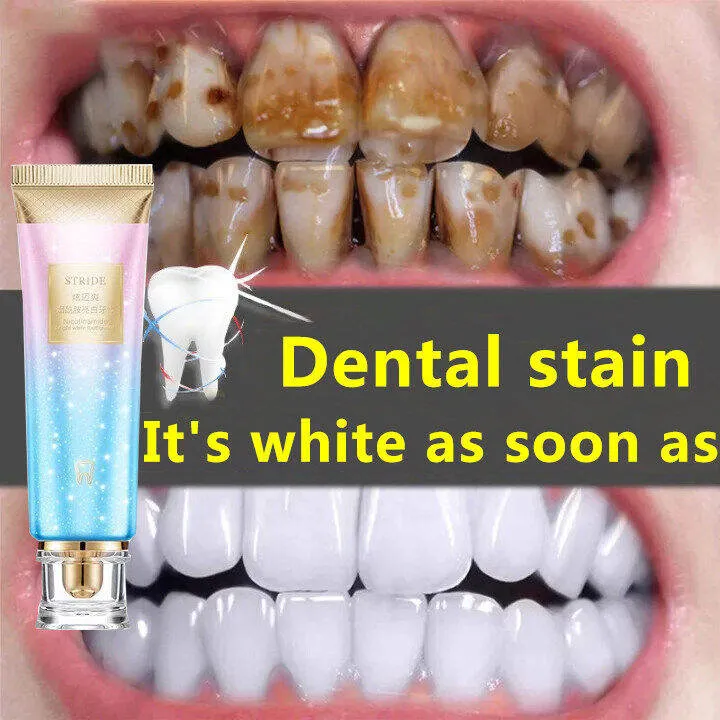 27095 whitening toothpaste pain