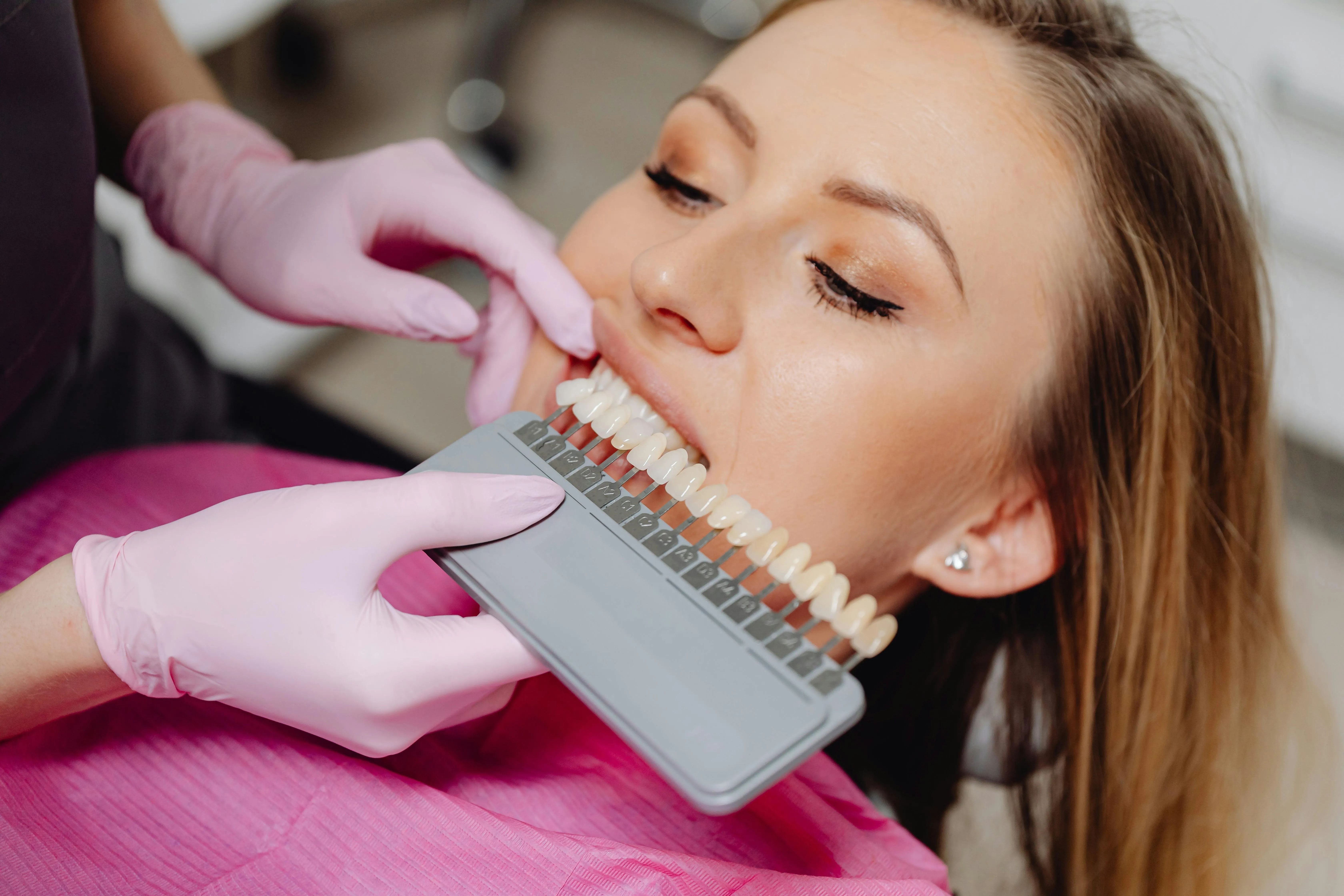 27100 teeth whitening photo angle