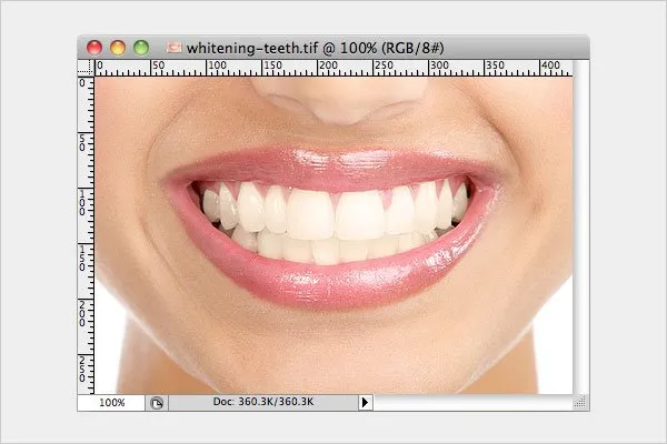 27100 teeth whitening photo lighting
