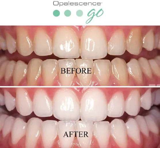 /img/27100-teeth-whitening-photo-props.webp