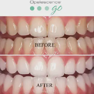 /img/27100-teeth-whitening-photo-props.webp