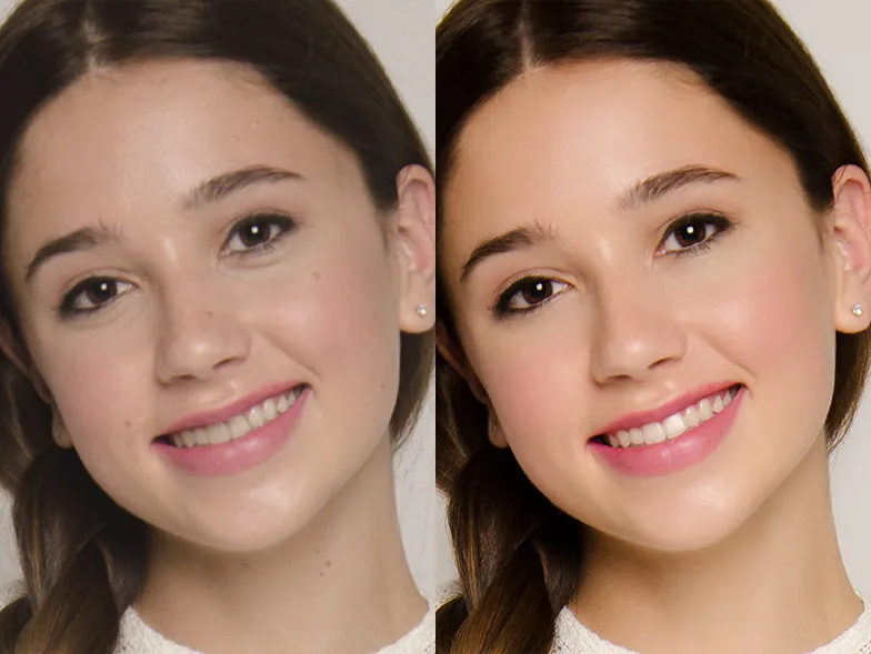 27100 teeth whitening photo smile practice