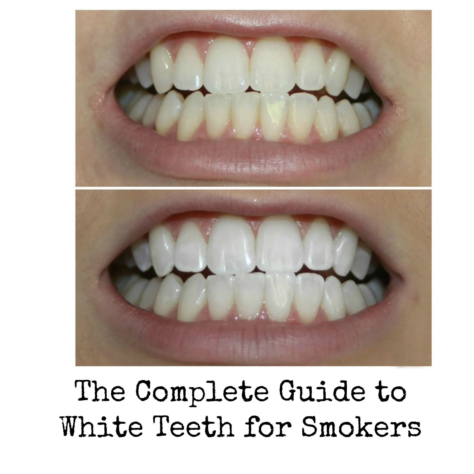 /img/27102-healthy-smile.webp