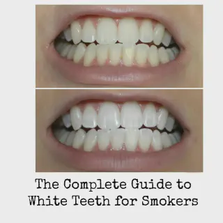 /img/27102-healthy-smile.webp