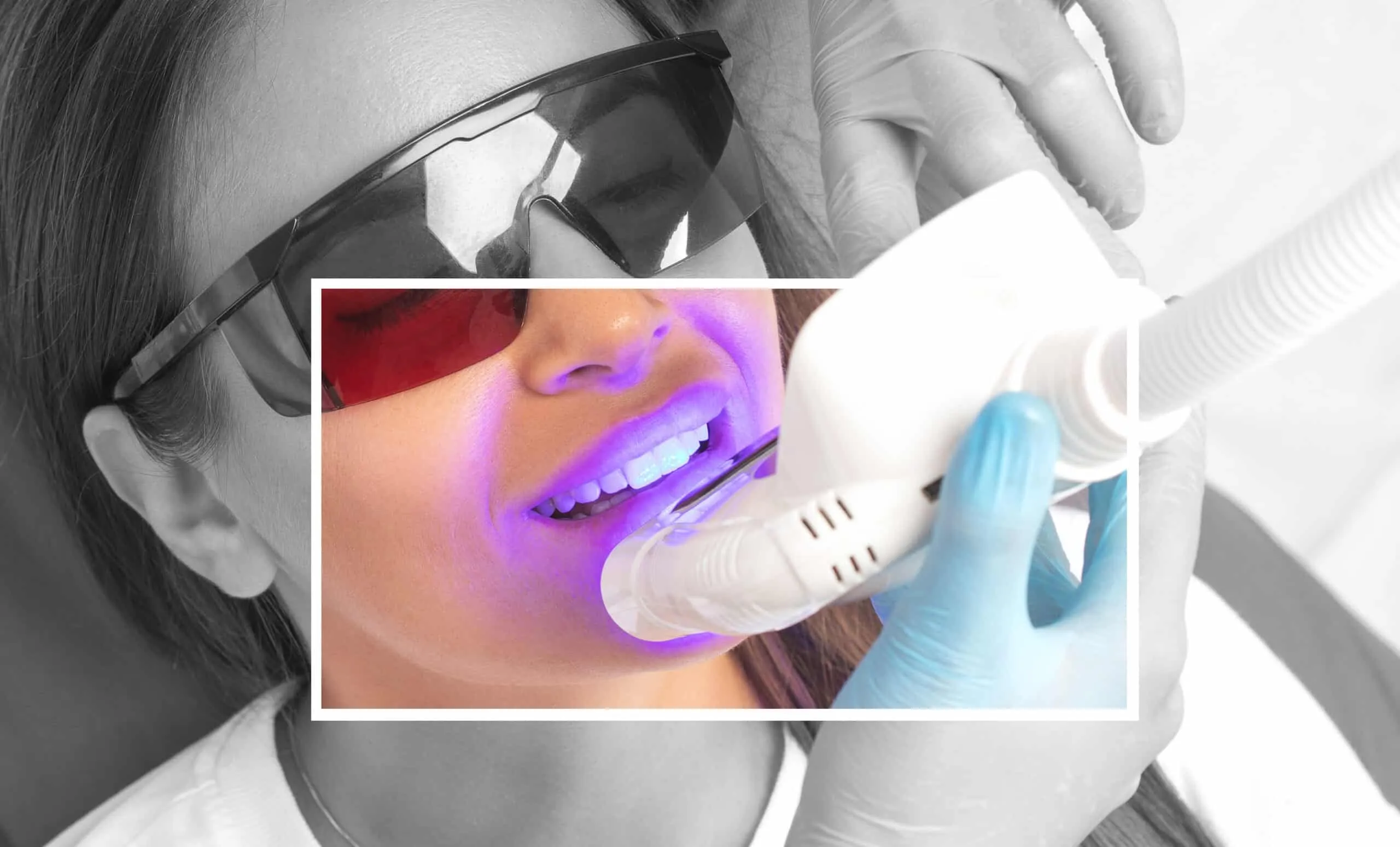 27102 stained teeth