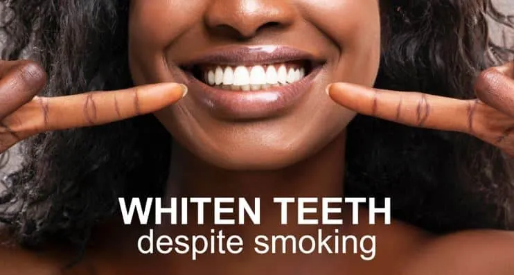 27102 teeth whitening treatment