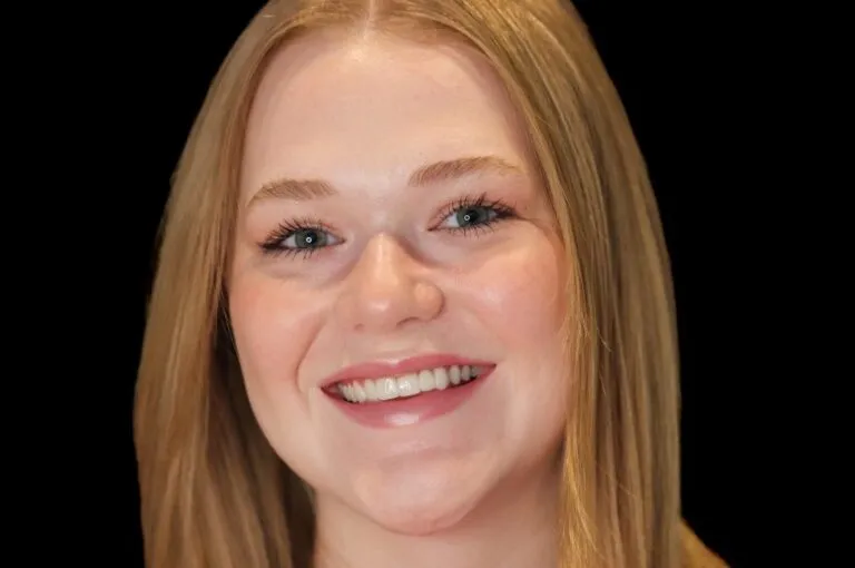 27103 teeth whitening savannah before after