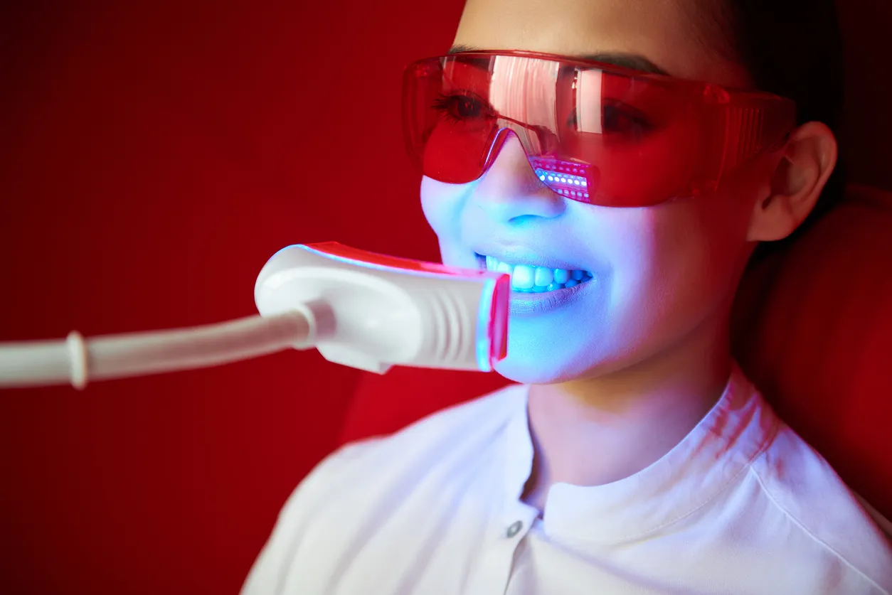 27103 teeth whitening savannah home kit