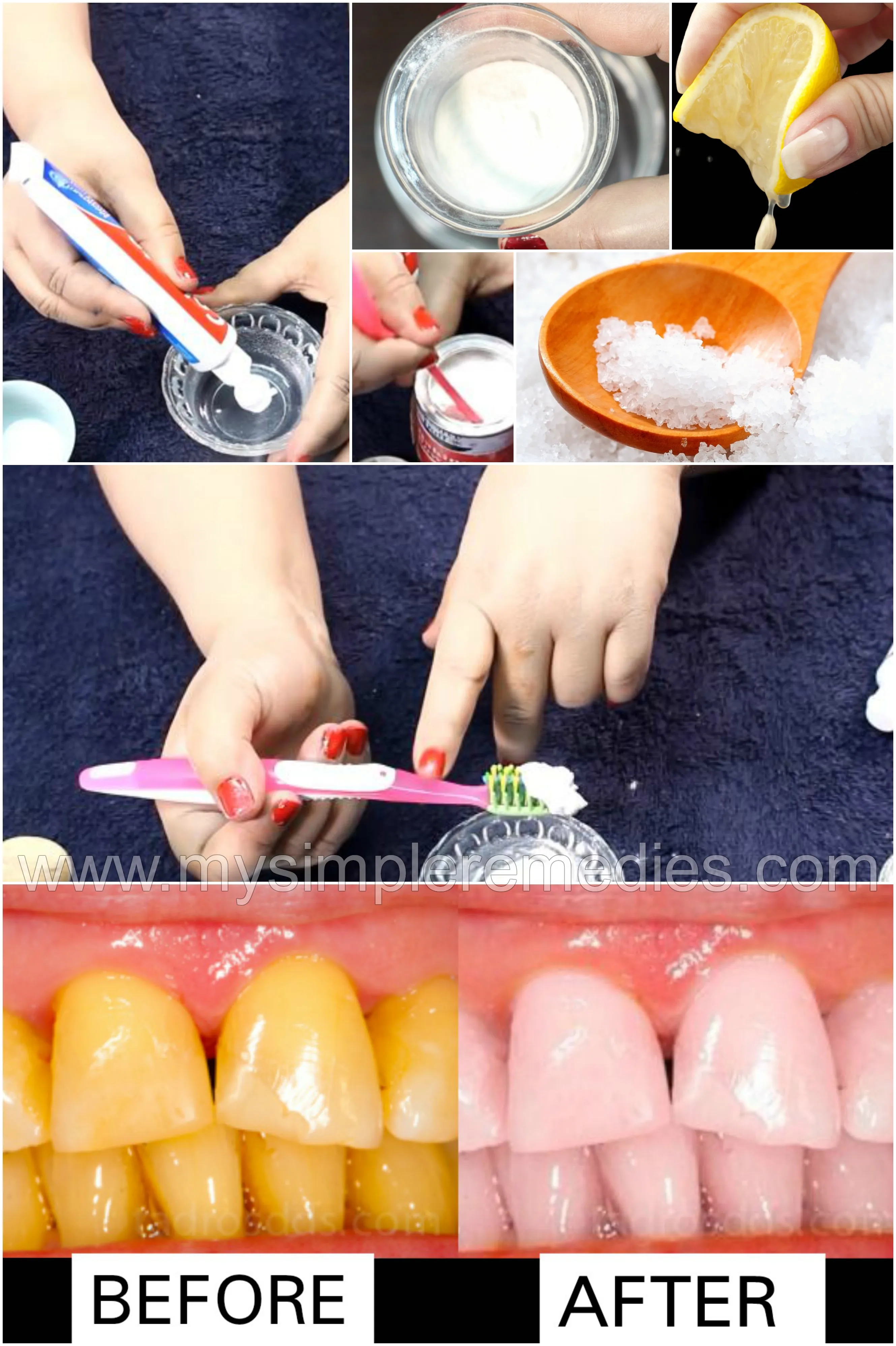 27107 apple cider vinegar teeth