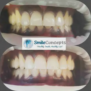 /img/27108-durham-teeth-whitening-aftercare.webp