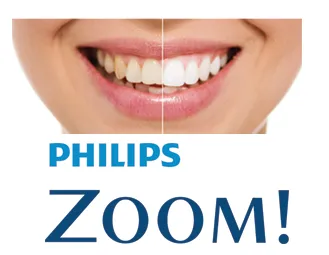 27108 teeth whitening durham smile
